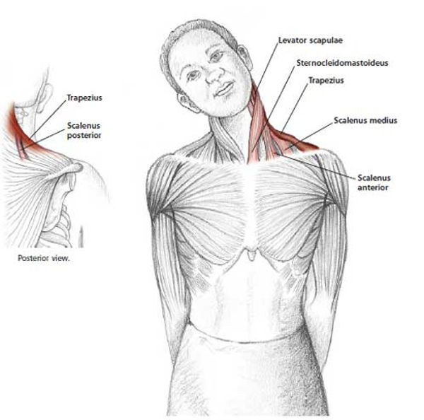 how-to-get-rid-of-a-crick-in-your-neck-chiropractor-jonesboro-aica