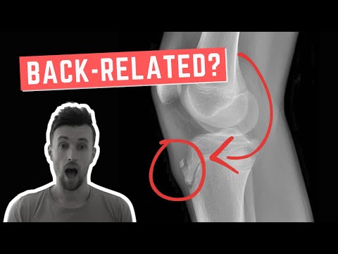 Why Osgood Schlatter Disease is Back-Related